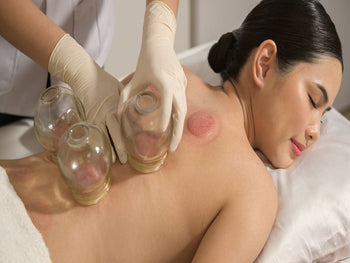 cupping