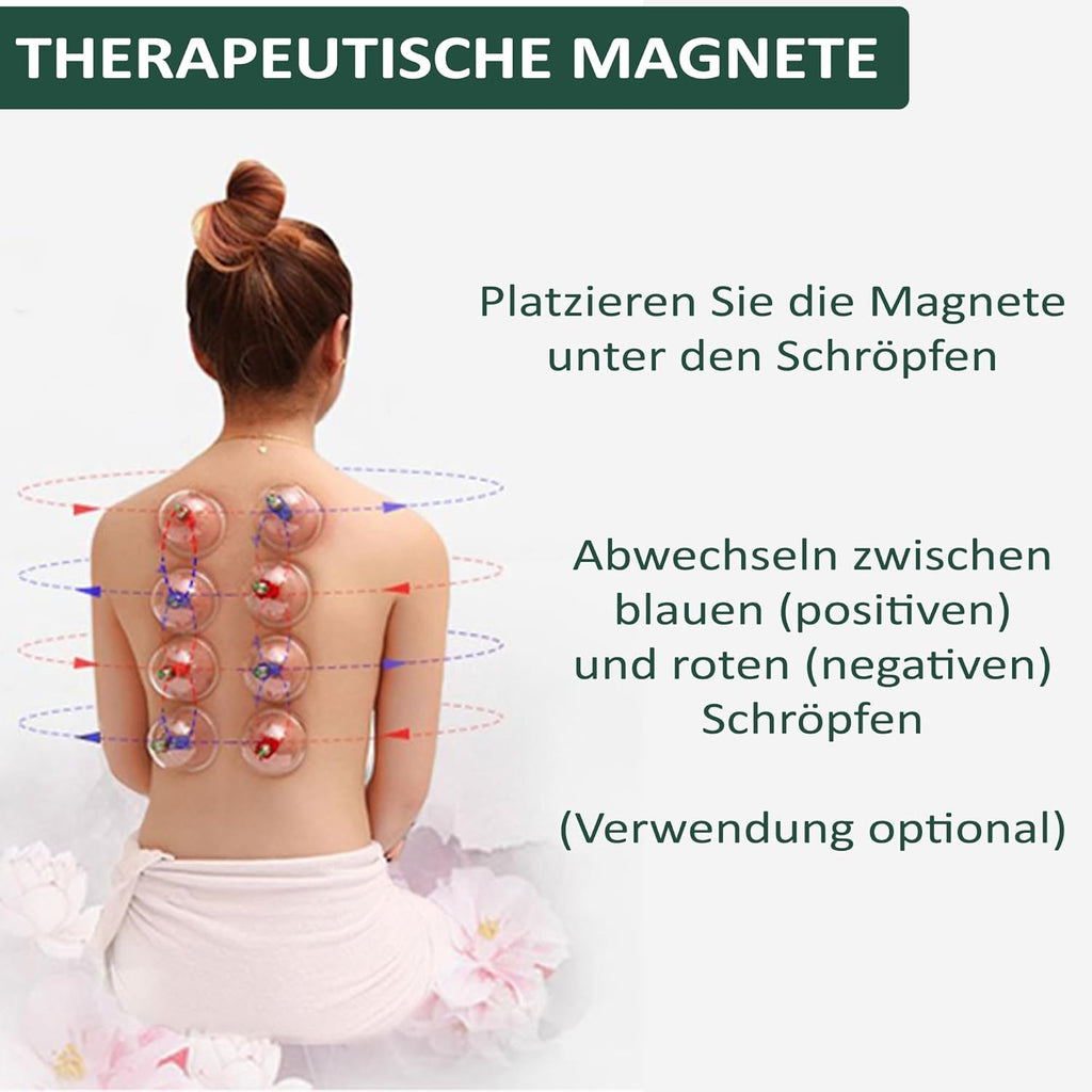 Uplife Schröpfgläser mit Vakuumpumpe - Schröpfset mit 24 Gläsern für Schröpfen & Cupping Therapie - Schröpfgerät & Massage Set Physiotherapie Zubehör - Cupping Set