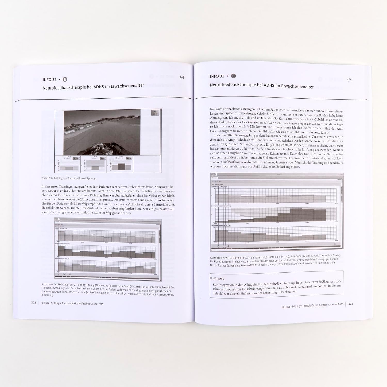 Therapie-Basics Biofeedback: Mit E-Book inside und Arbeitsmaterial (Beltz Therapie-Basics)