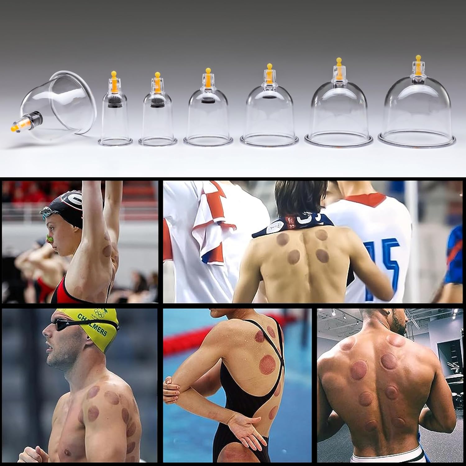 Uplife Schröpfgläser mit Vakuumpumpe - Schröpfset mit 24 Gläsern für Schröpfen & Cupping Therapie - Schröpfgerät & Massage Set Physiotherapie Zubehör - Cupping Set